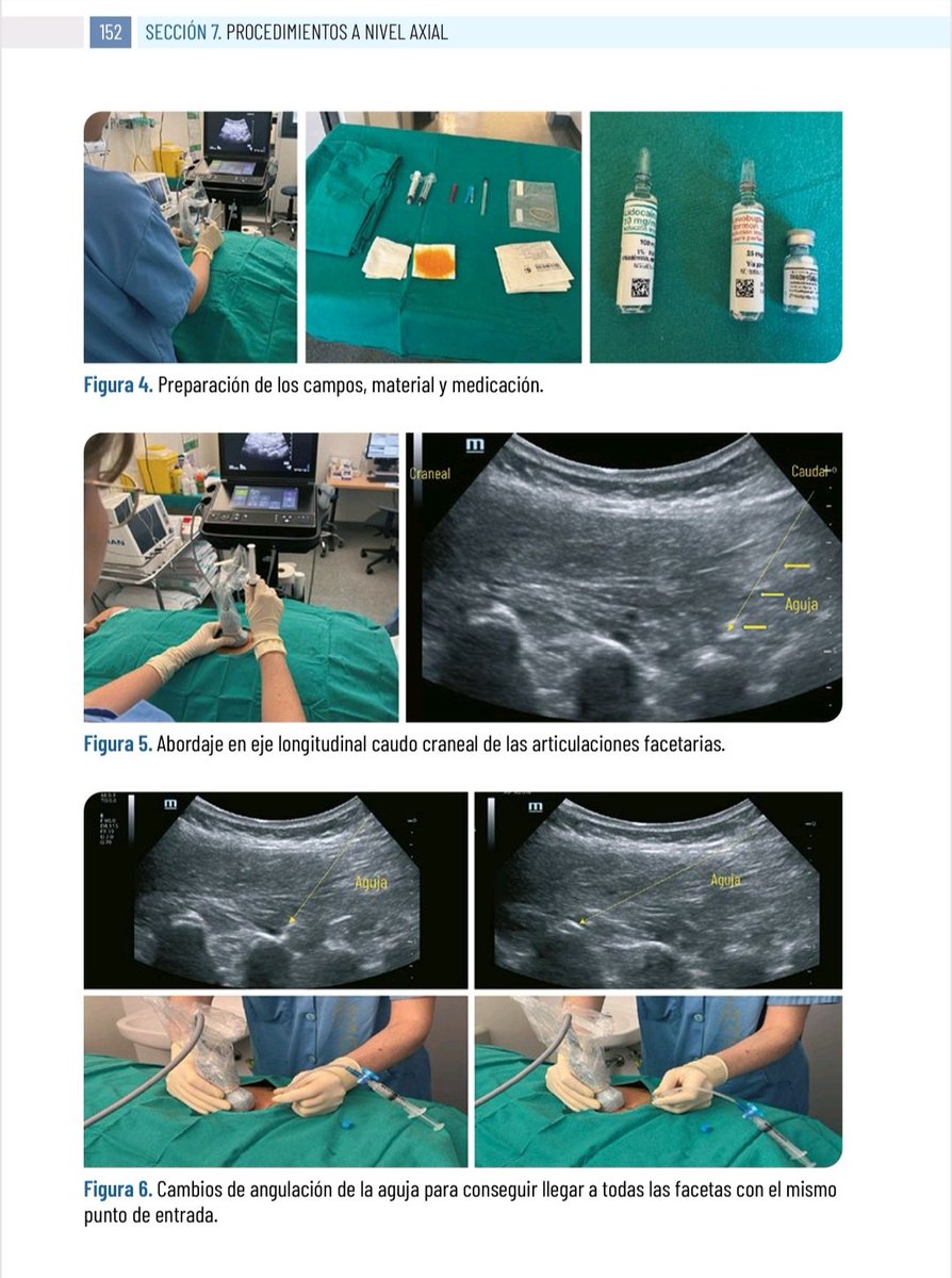 Una pequeña muestra...