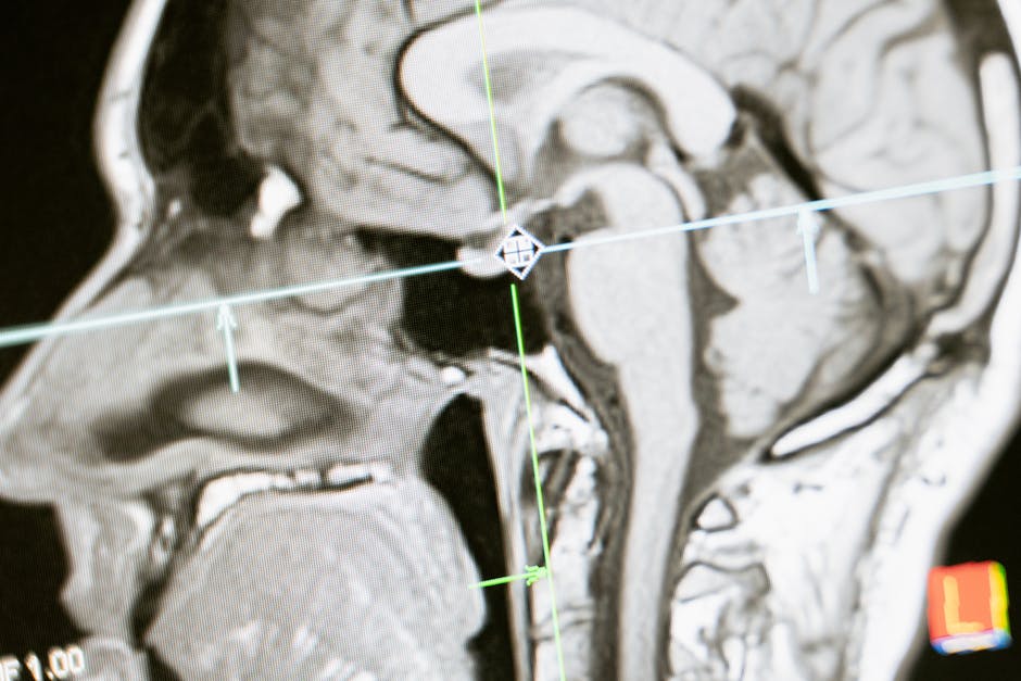 TheCenter62201's tweet image. Opioids impact the brain long-term 🤯, causing structural changes & affecting decision-making 📉. They slow brain function & can cause damage. 🧠 Help & support: (618) 482-7330. 📞
#OpioidEffects #BrainChanges