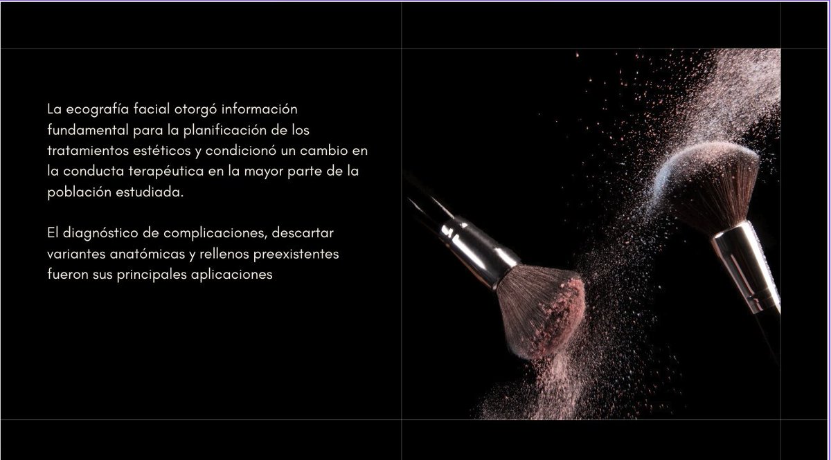 Luisa Nieto (@luisaniemor) on Twitter photo No te pierdas el artículo revisado en el Espacio Editorial Virtual de la "revista Argentina" , por el Dr. Jiménez Lasanta, sobre el "aporte de la ecografia en la estética"👇 seram.es/espacio-editor…
<a href="/residentesSERAM/">Residentes SERAM</a> <a href="/MskSerme/">SERME</a> <a href="/SERAM_RX/">SERAM - Sociedad Española de Radiología Médica</a> <a href="/RarRevista/">RAR</a> No te pierdas el artículo revisado en el Espacio Editorial Virtual de la "revista Argentina" , por el Dr. Jiménez Lasanta, sobre el "aporte de la ecografia en la estética"👇 seram.es/espacio-editor…
<a href="/residentesSERAM/">Residentes SERAM</a> <a href="/MskSerme/">SERME</a> <a href="/SERAM_RX/">SERAM - Sociedad Española de Radiología Médica</a> <a href="/RarRevista/">RAR</a>