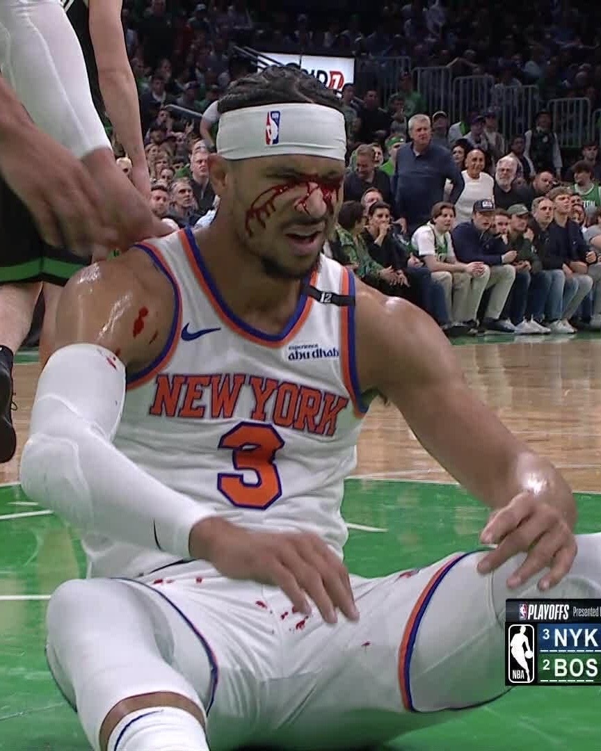 BleacherReport's tweet image. Josh Hart was elbowed in the face... oh my 😳