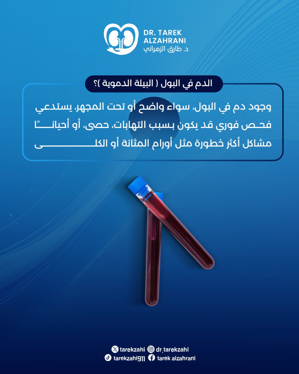 الدم في البول ( البيلة الدموية )

"ظهور دم في البول ليس أمراً طبيعياً! تجاهله قد يؤدي لمضاعفات خطيرة. راجع طبيبك فوراً لتحديد السبب والعلاج المناسب.

#البيلة_الدموية

#دم_في_البول

#صحة_الكلى

#أمراض_المسالك_البولية

#تنبيه_صحي

#تحليل_البول

#مشاكل_البول