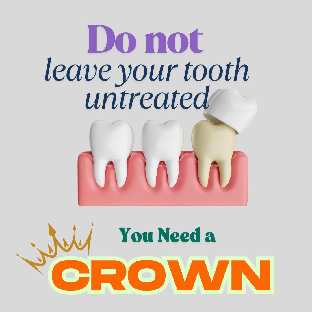 aucdental's tweet photo. Done with RCT ? Go for Crown !
Book your Dental Visit now : https://t.co/y17QwJMM5W
#bestdentistnearme #rootcanal #teethcleaning #toothache #toothcavity #dentist #ahmedabad #mumbai #jabalpur #agra #bangalore #delhi #dentalpain #toothpain #NRI #vileparledentist #dentistatvileparle #dentistatandheri #andheridentist #whiteteeth #onlinedentalawarenesscampaign #9136362032