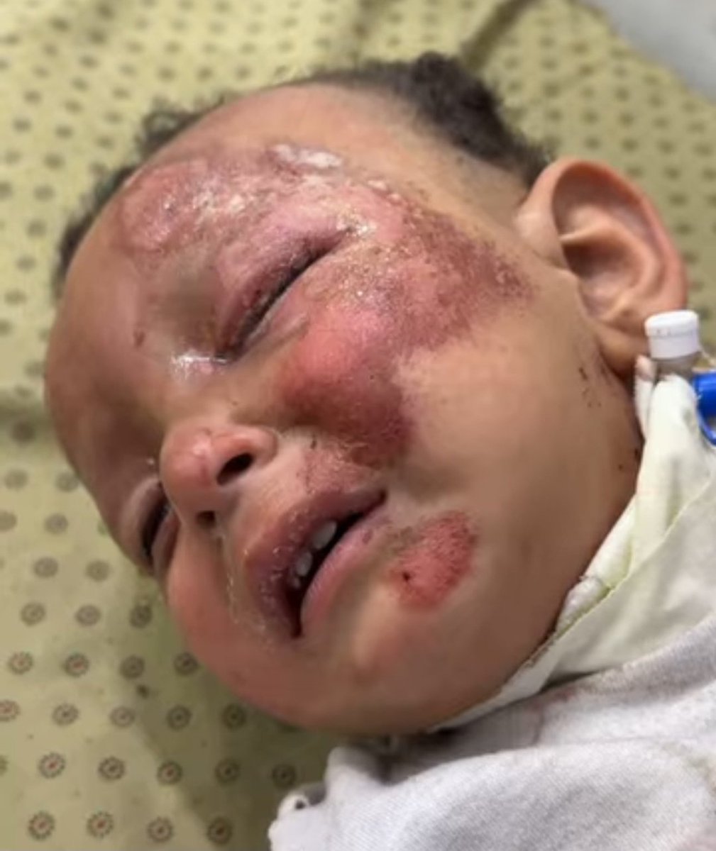 PLEASE DON'T SKIP ME :((

My account has been restricted, 
So, my gfm doesn't appear to everyone! 
Please support my family gfm !!!!
by sharing and quoting and donating 💔🙏🏻🚨

Please, Leave a comment 🇵🇸 or

gofund.me/760e5c7d