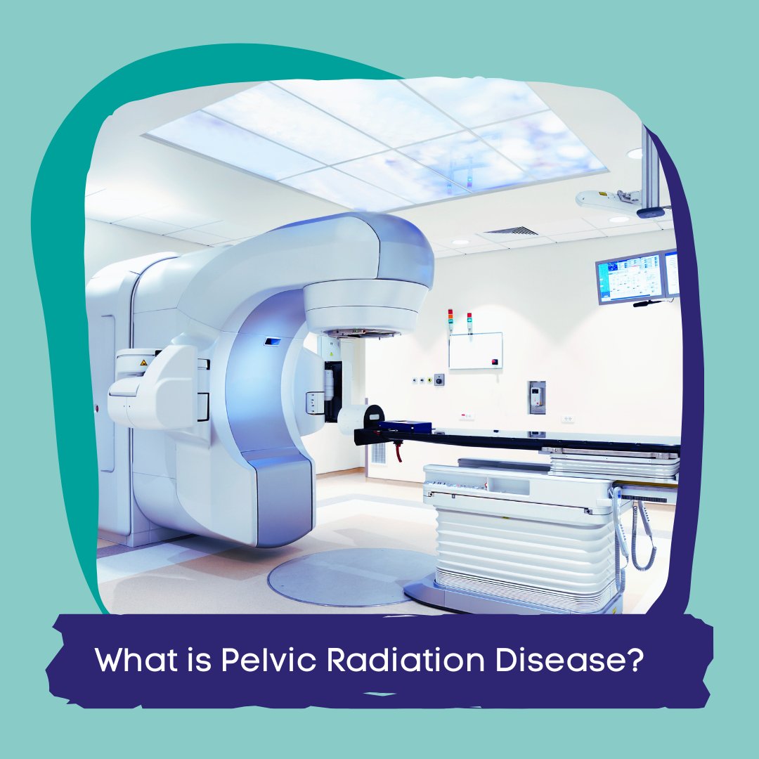 New or ongoing symptoms 3 months or more after pelvic radiotherapy could be #PelvicRadiationDisease

Symptoms can start years or even decades after radiotherapy and are often under-recognised. Find more information on our website:

prda.org.uk/what-is-pelvic…