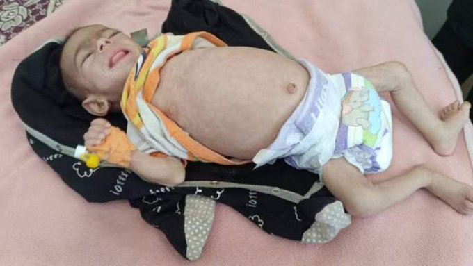 الصورة