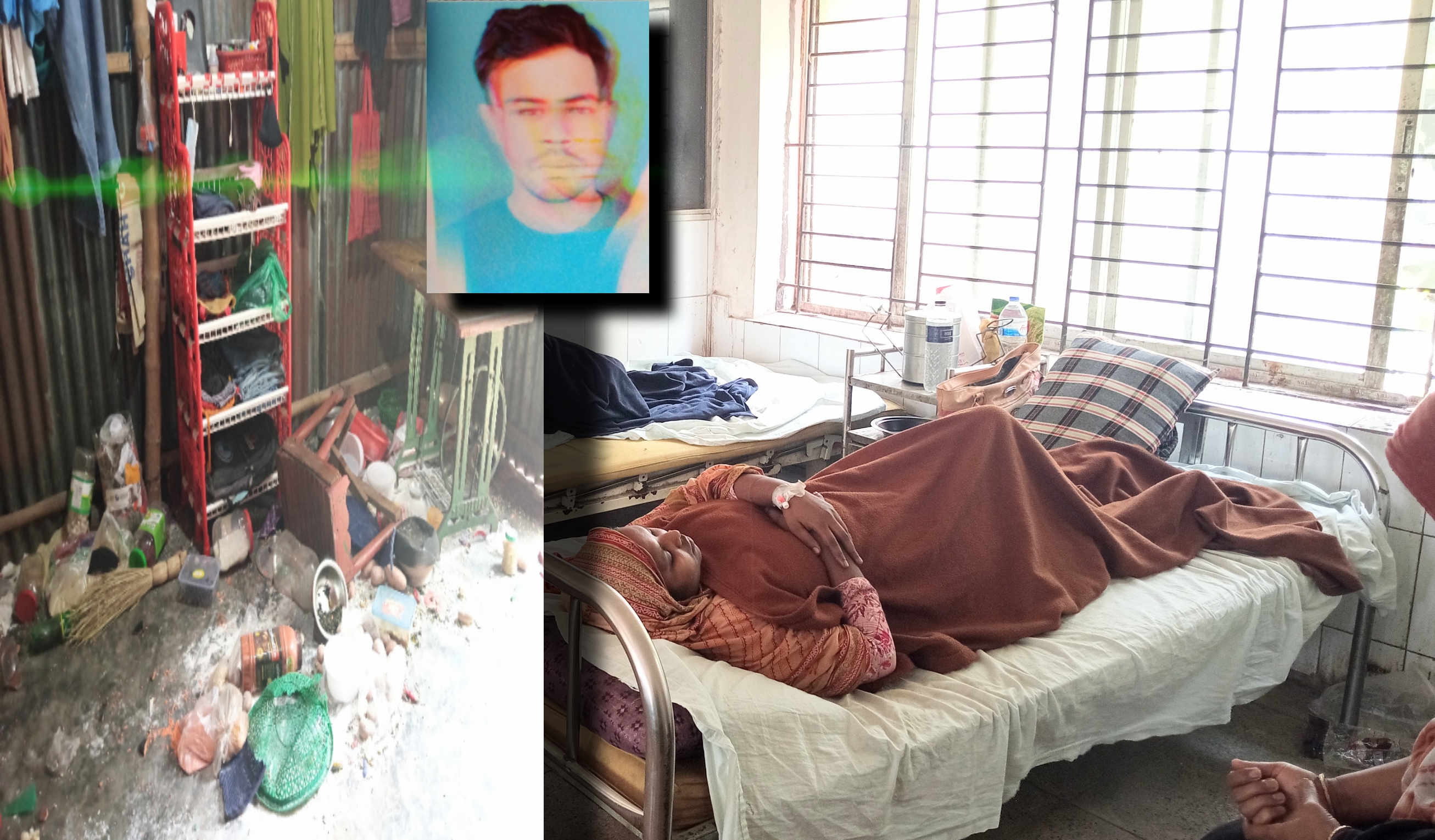 সরিষাবাড়ীতে স্বামীর নির্মম নির্যাতনের শিকার হয়ে গৃহবধূ হাসপাতালে