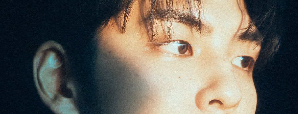 주근깨라니 주근깨라니💕💕💕