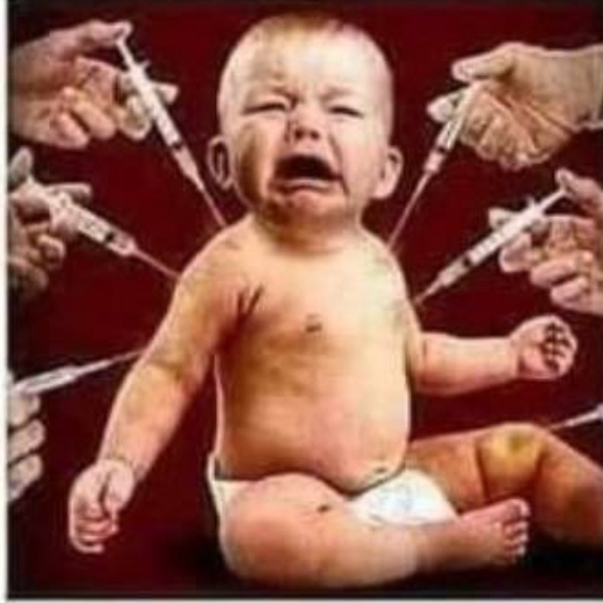 Child has a reaction from a bee sting, Pediatrician believes the parent.

Child has a reaction from peanuts, Pediatrician believes the parent.

Child has a reaction from an antibiotic, Pediatrician believes the parent.

Child has a reaction from a vaccine, Pediatrician doesn't