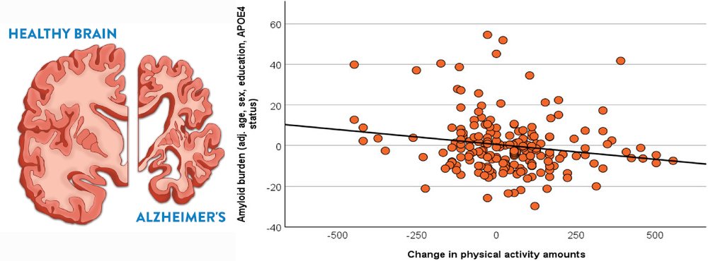 Higher physical activity is associated with lower brain amyloid burden - a key protein linked to Alzheimer’s dementia.

🧵1/11