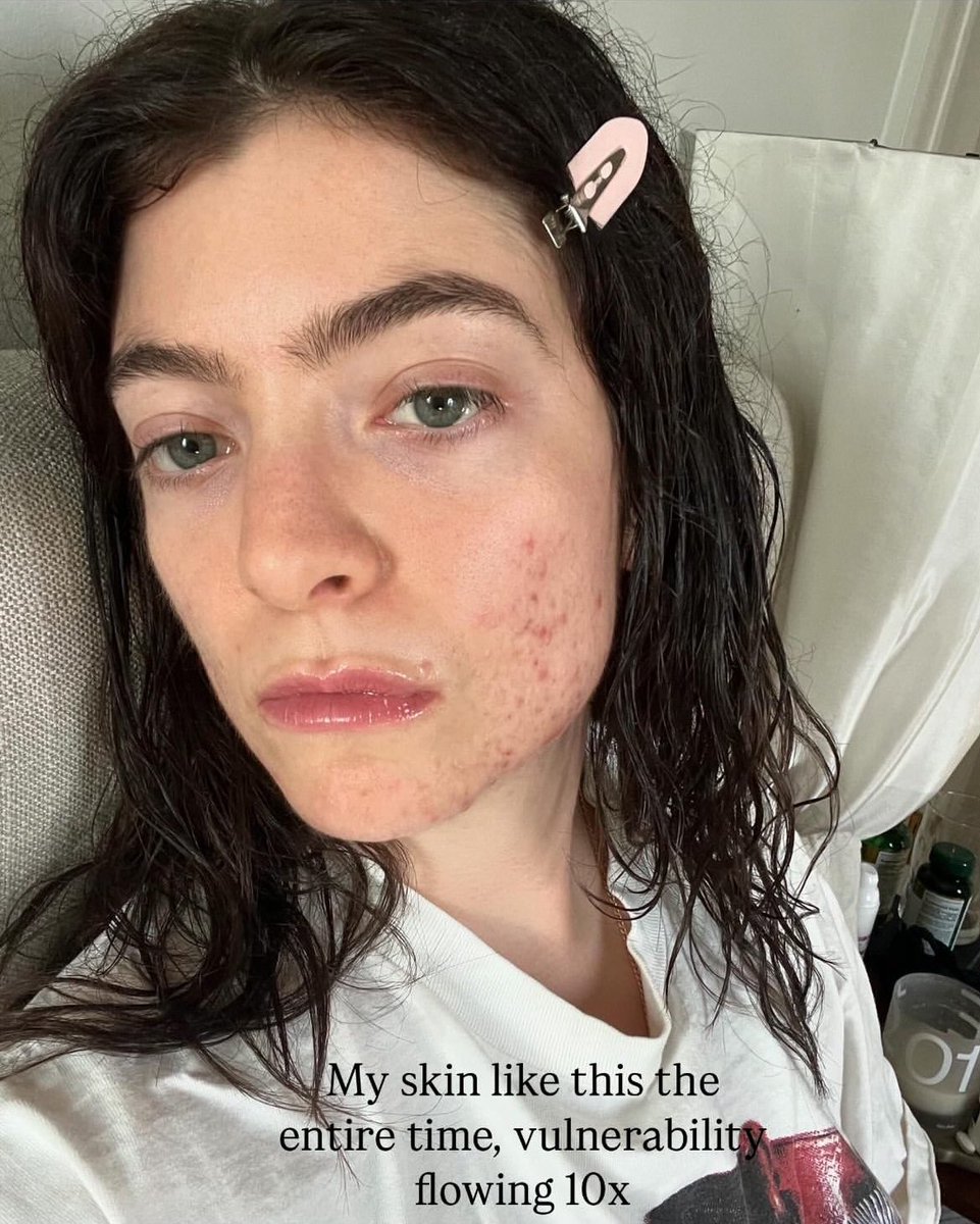 braedenlorde's tweet photo. So apparently Lorde's prescription for SPIT is actually an anti-androgen (testosterone blocker) that is not only used for treating acne, but also PCOS symptoms. The way this aligns perfectly with the theme of Virgin... https://t.co/PYnqveUdBD
