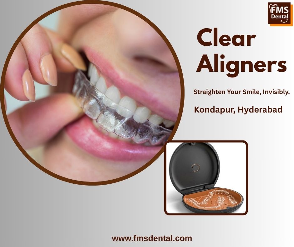 fmsdentall's tweet photo. Examine the Best Clear Aligners in Kondapur for a Self-Assured Smile
Get the smile you’ve always wanted with the Best Clear Aligners in Kondapur, designed for comfort and precision.
For More Details :https://t.co/YgIQP0BnKm

#BestCosmeticDentalClinicinKondapur https://t.co/Jq4oPK8IKA