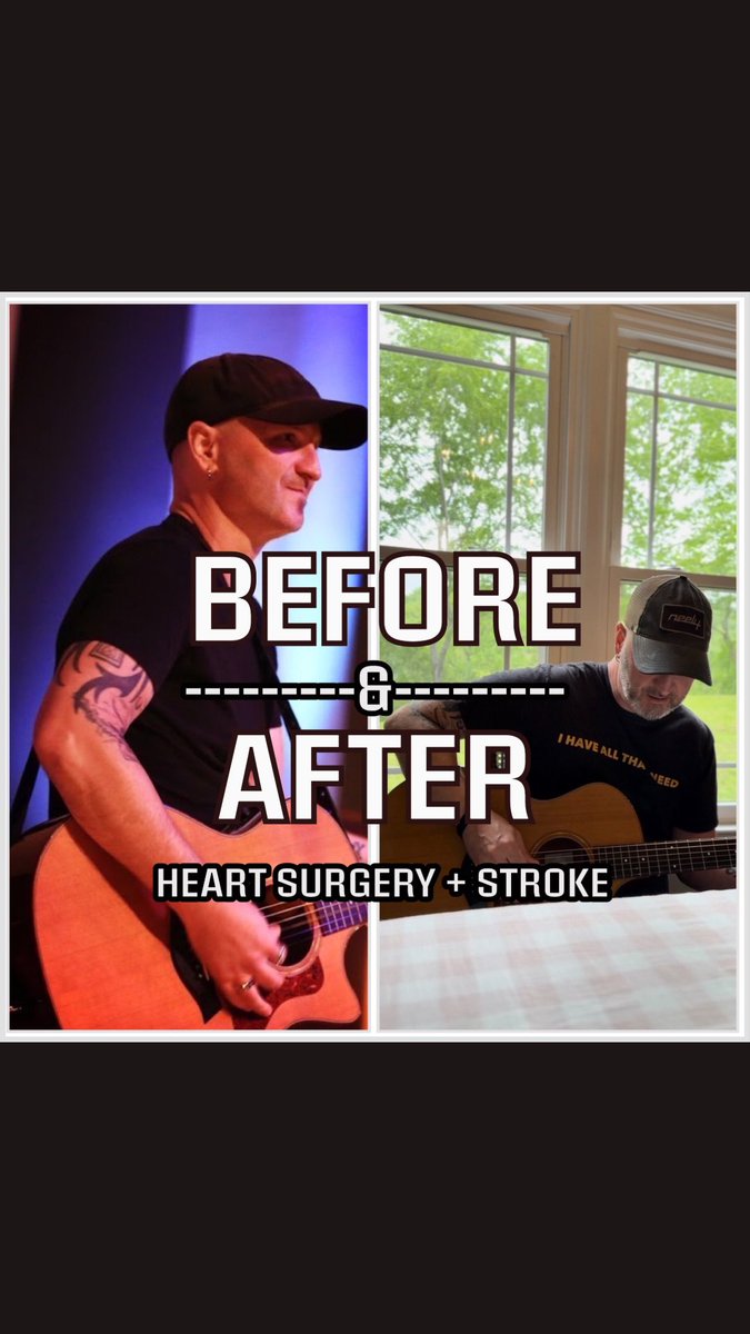 Tried playing riffs from songs I wrote.
One came easy. The other… reminded me how far I still have to go.
This is what recovery looks like.

Watch the short clip:
youtu.be/e0JquWEu874?si…

#StrokeSurvivor #HeartSurgery #Guitarist #BeforeAndAfter #NeelyMusic #YouTubeShorts