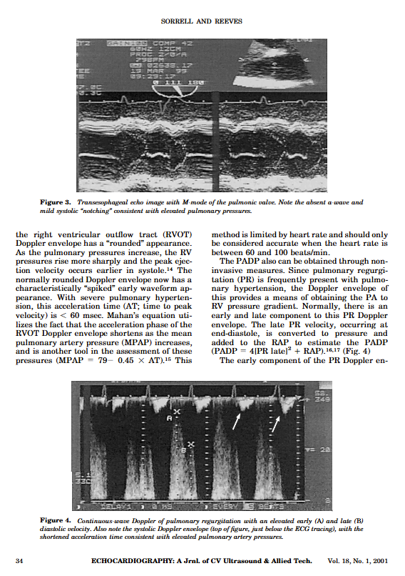 V.L.Sorrell, MD (@CASEfromASE EIC) (@vlsorrellimages) on Twitter photo Here is the entire document (but the figure is my fave)... follow thread for pics:
#JADEL <a href="/ASE360/">American Society of Echocardiography</a> <a href="/CASEfromASE/">CV Case Journal</a> Here is the entire document (but the figure is my fave)... follow thread for pics:
#JADEL <a href="/ASE360/">American Society of Echocardiography</a> <a href="/CASEfromASE/">CV Case Journal</a>