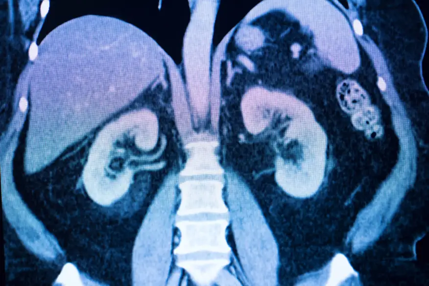 MicroplastX tweet media