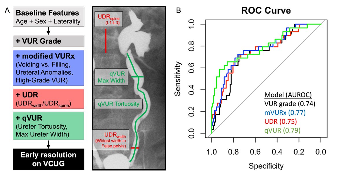 Adree Khondker (@adreekhondker) on Twitter photo Can we do better than grade in predicting spontaneous resolution in vesicoureteral reflux? Our new work in <a href="/jpurology/">Journal of Pediatric Urology</a> showed that novel models can improve predictive ability. Thanks for the collaboration! <a href="/ArmandoJLorenzo/">Armando J. Lorenzo</a> <a href="/DrAndrewKirsch/">ANDREW KIRSCH</a> <a href="/Coopeduro/">Christopher Cooper</a>
Link: doi.org/10.1016/j.jpur… Can we do better than grade in predicting spontaneous resolution in vesicoureteral reflux? Our new work in <a href="/jpurology/">Journal of Pediatric Urology</a> showed that novel models can improve predictive ability. Thanks for the collaboration! <a href="/ArmandoJLorenzo/">Armando J. Lorenzo</a> <a href="/DrAndrewKirsch/">ANDREW KIRSCH</a> <a href="/Coopeduro/">Christopher Cooper</a>
Link: doi.org/10.1016/j.jpur…