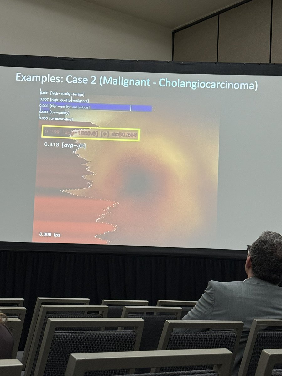 Vinay Chandrasekhara, MD (@vinaychandramd) on Twitter photo π₯Great way to kick off #DDW2025
Former <a href="/MayoClinicGIHep/">Mayo Clinic Gastroenterology & Hepatology</a> AE fellow Neil Marya presenting his prospective real -time AI cholangioscopy study <a href="/UMassGI/">University of Massachusetts GI Fellowship</a> π₯Great way to kick off #DDW2025
Former <a href="/MayoClinicGIHep/">Mayo Clinic Gastroenterology & Hepatology</a> AE fellow Neil Marya presenting his prospective real -time AI cholangioscopy study <a href="/UMassGI/">University of Massachusetts GI Fellowship</a>