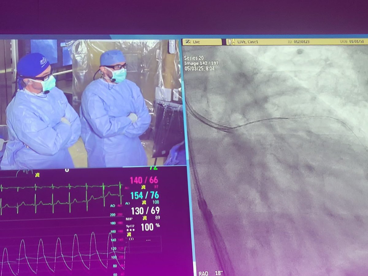 Asaad Nakhle, MD (@asaadnakhle) on Twitter photo First live case as primary operator ✅. Thanks to <a href="/SCAI/">SCAI</a> for the opportunity. Most importantly, thanks to <a href="/KAlaswadMD/">Khaldoon Alaswad MD</a> for the unwavering trust and continued support <a href="/HenryFordHealth/">Henry Ford Health</a> <a href="/HFHCardioFellow/">Henry Ford Hospital Cardiology Fellowship</a>. #SCAI2025 First live case as primary operator ✅. Thanks to <a href="/SCAI/">SCAI</a> for the opportunity. Most importantly, thanks to <a href="/KAlaswadMD/">Khaldoon Alaswad MD</a> for the unwavering trust and continued support <a href="/HenryFordHealth/">Henry Ford Health</a> <a href="/HFHCardioFellow/">Henry Ford Hospital Cardiology Fellowship</a>. #SCAI2025