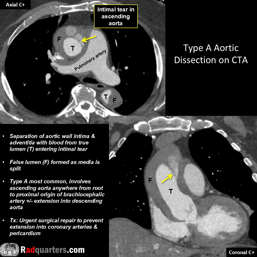 Radquarters's tweet image. #FOAMrad #FOAMed #radres #radtech #medstudent #radquarters