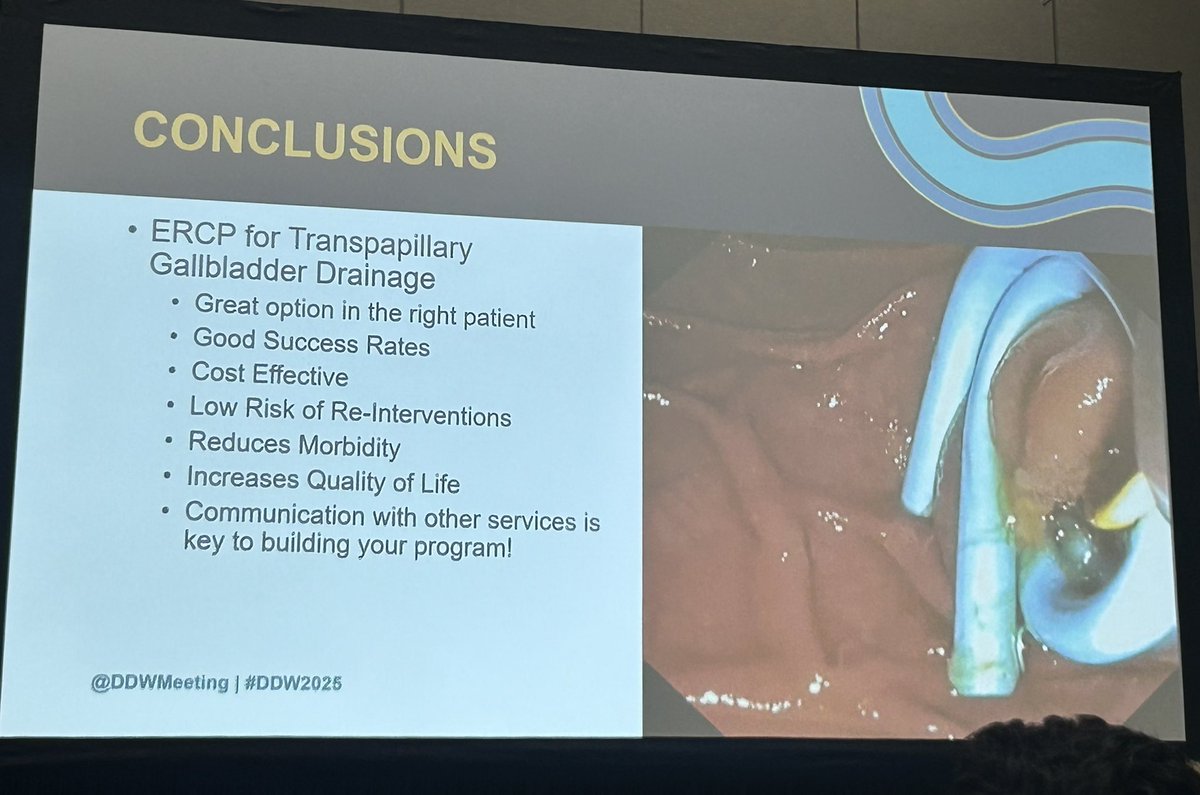 Sunil Amin, MD, FASGE, FRCPC (@sunilaminmd) on Twitter photo Proud of <a href="/TomTielleman/">Tom Tielleman, MD</a> watching his rise over the past few years
Incredible talk today on #ERCP for transpap GB drainage
✅ Huge discrepancy between ET-GBD and C-tubes
✅ Rotating tomes, cholangioscopy, haber ramps - lots of ways to get this done!
<a href="/ASGEendoscopy/">ASGE GI Endoscopy</a> <a href="/DDWMeeting/">Digestive Disease Week</a> Proud of <a href="/TomTielleman/">Tom Tielleman, MD</a> watching his rise over the past few years
Incredible talk today on #ERCP for transpap GB drainage
✅ Huge discrepancy between ET-GBD and C-tubes
✅ Rotating tomes, cholangioscopy, haber ramps - lots of ways to get this done!
<a href="/ASGEendoscopy/">ASGE GI Endoscopy</a> <a href="/DDWMeeting/">Digestive Disease Week</a>