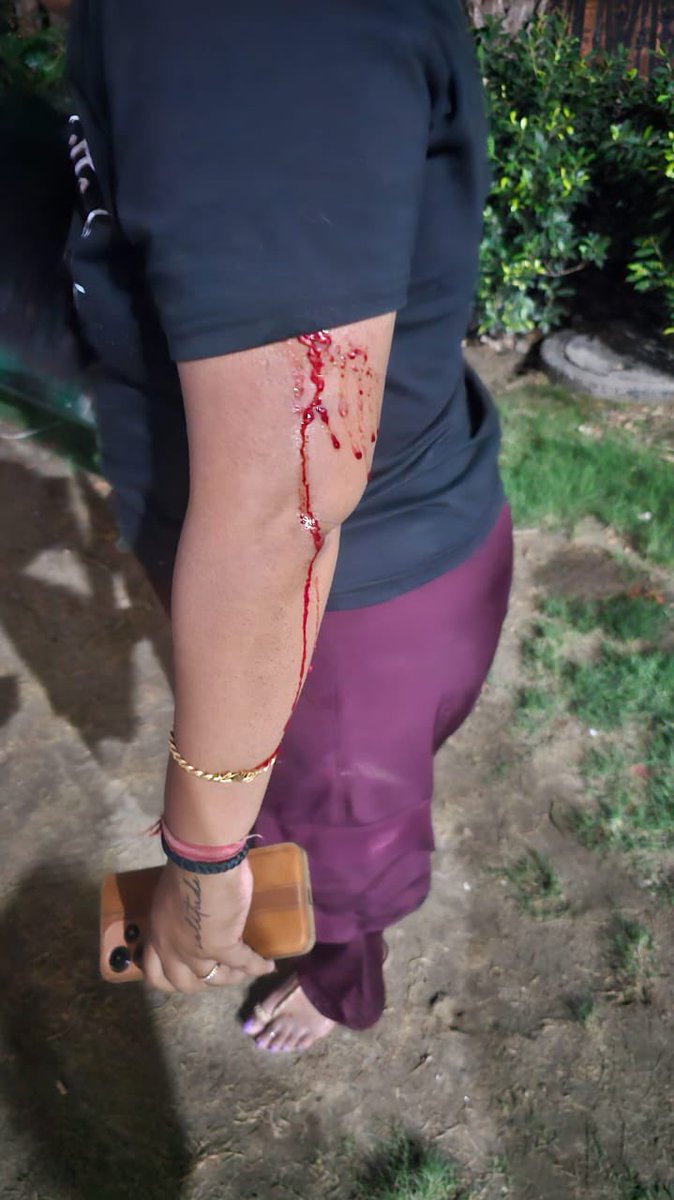 <a href="/noida_authority/">NOIDA Authority</a> <a href="/GreenKarmic/">Karmic Green Social Welfare Society</a> <a href="/rituias2003/">Ritu maheshwari</a> <a href="/noida_authority/">NOIDA Authority</a> 3-4 saal se complain kar rhe lekin aap log koi karwai nhi kar rhe h society me awara kutte badhte ja rhe jo k i bacho ko to  ka i baro ko kaat rahe <a href="/Joginde05957128/">Joginder Singh ( आम नागरिको की आवाज)</a> plz help <a href="/nefowaoffice/">NEFOWA</a> aaj ek mahila par kutto ne attack kiye