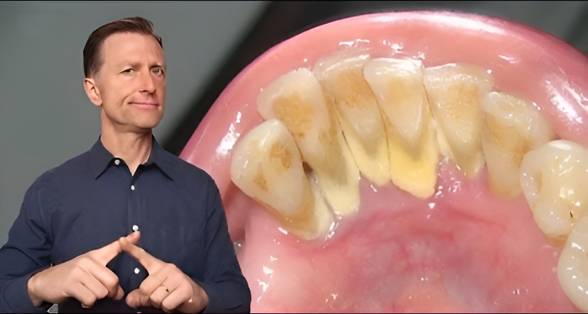 العلاج الأول لجير الأسنان وأسباب رائحة الفم الكريهة:

تنظيف الأسنان بالفرشاة مرتين يوميًا لا يكفي لمنع الجير.

هذا التراكم الصلب على أسنانك عبارة عن بكتيريا محمية بطبقة معدنية.

إليك علاج بسيط بثلاثة مكونات للتخلص من الجير بشكل طبيعي

بدءًا من المكون الأول إحفظ عندك وتابع معي...