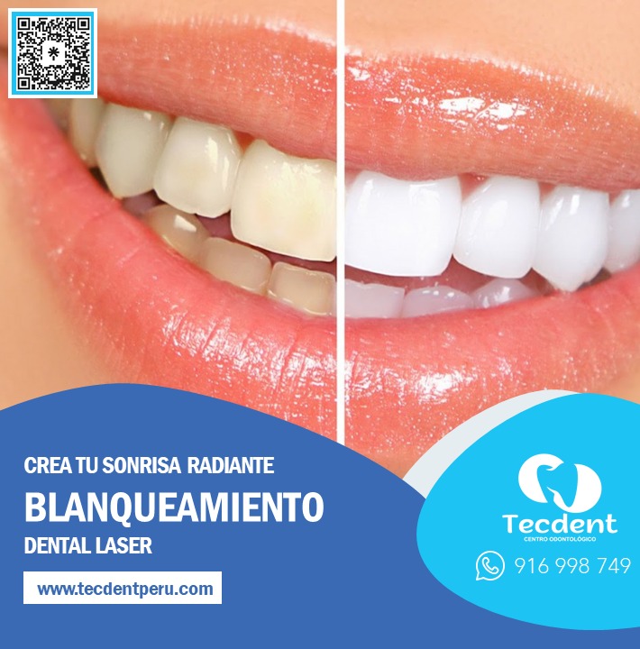 Tecdentperu's tweet photo. 💙Con el paso del tiempo y según el tipo de alimentación, es común que el color de nuestro esmalte dental vaya cambiando y adquiera un tono amarillento, llegando incluso a aparecer manchas. 

#tecdentperu #creandotusonrisaideal https://t.co/I7dLqZQzEu