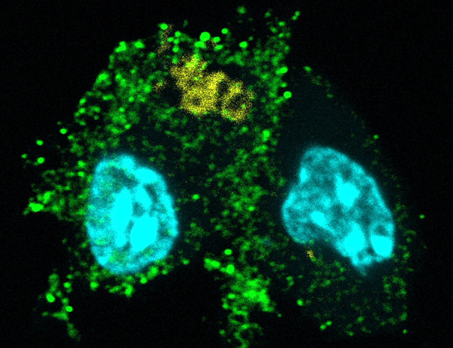 Science Immunology (@sciimmunology) on Twitter photo Scientists have discovered that the uptake of apoptotic #neutrophils can switch #AlveolarMacrophages to favor inflammation resolution over antibacterial responses in mice. <a href="/UKGM_Presse/">UKGM Gießen und Marburg</a>
Learn more in Science #Immunology: scim.ag/4dgWmfD Scientists have discovered that the uptake of apoptotic #neutrophils can switch #AlveolarMacrophages to favor inflammation resolution over antibacterial responses in mice. <a href="/UKGM_Presse/">UKGM Gießen und Marburg</a>
Learn more in Science #Immunology: scim.ag/4dgWmfD