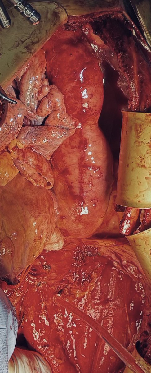 Jeromy Brink, MD tweet media