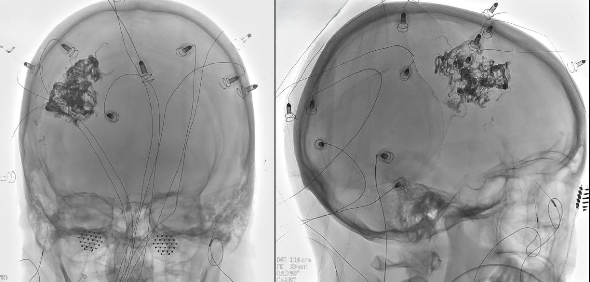 Carlos Castaño tweet media