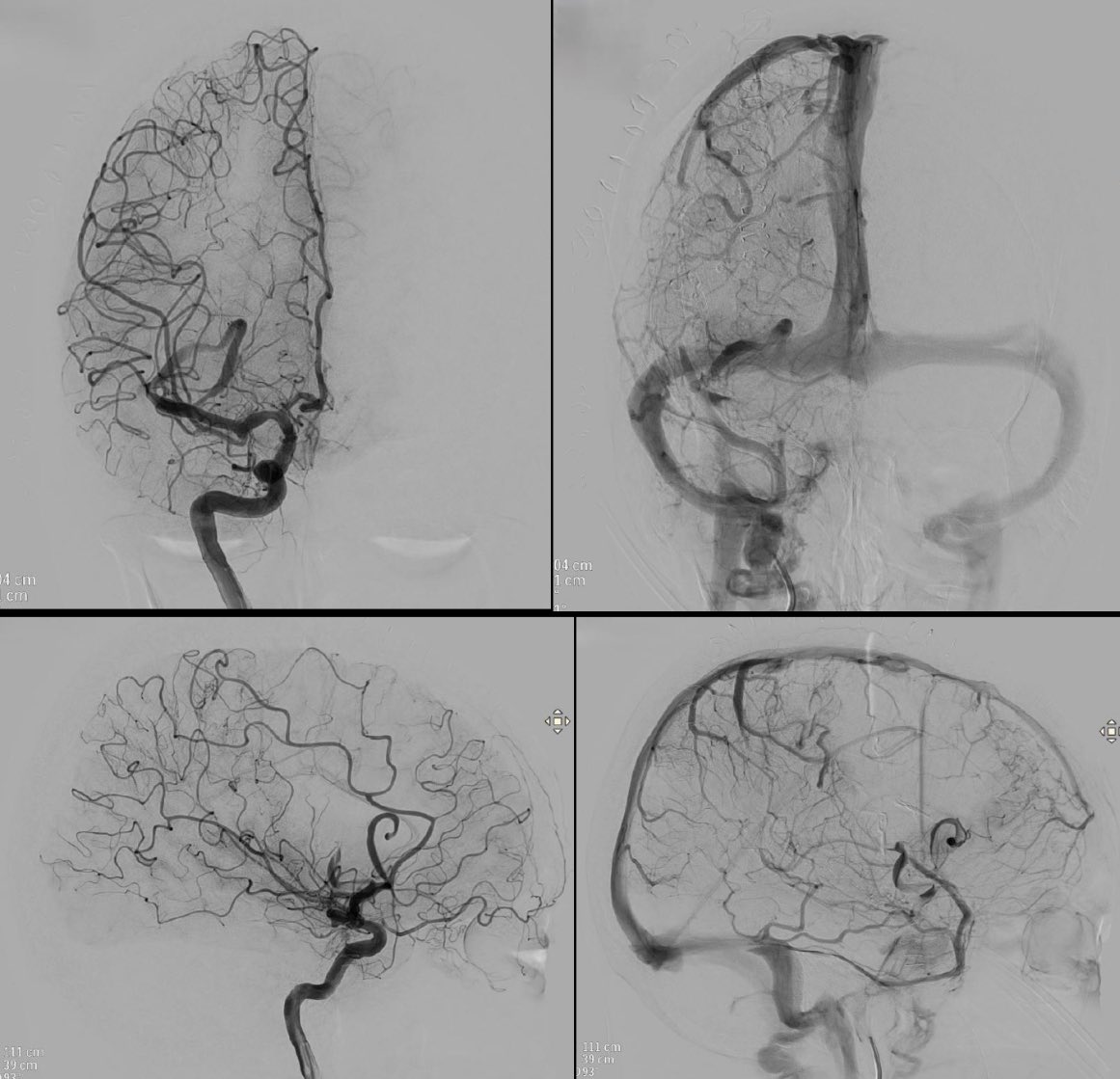 Carlos Castaño tweet media