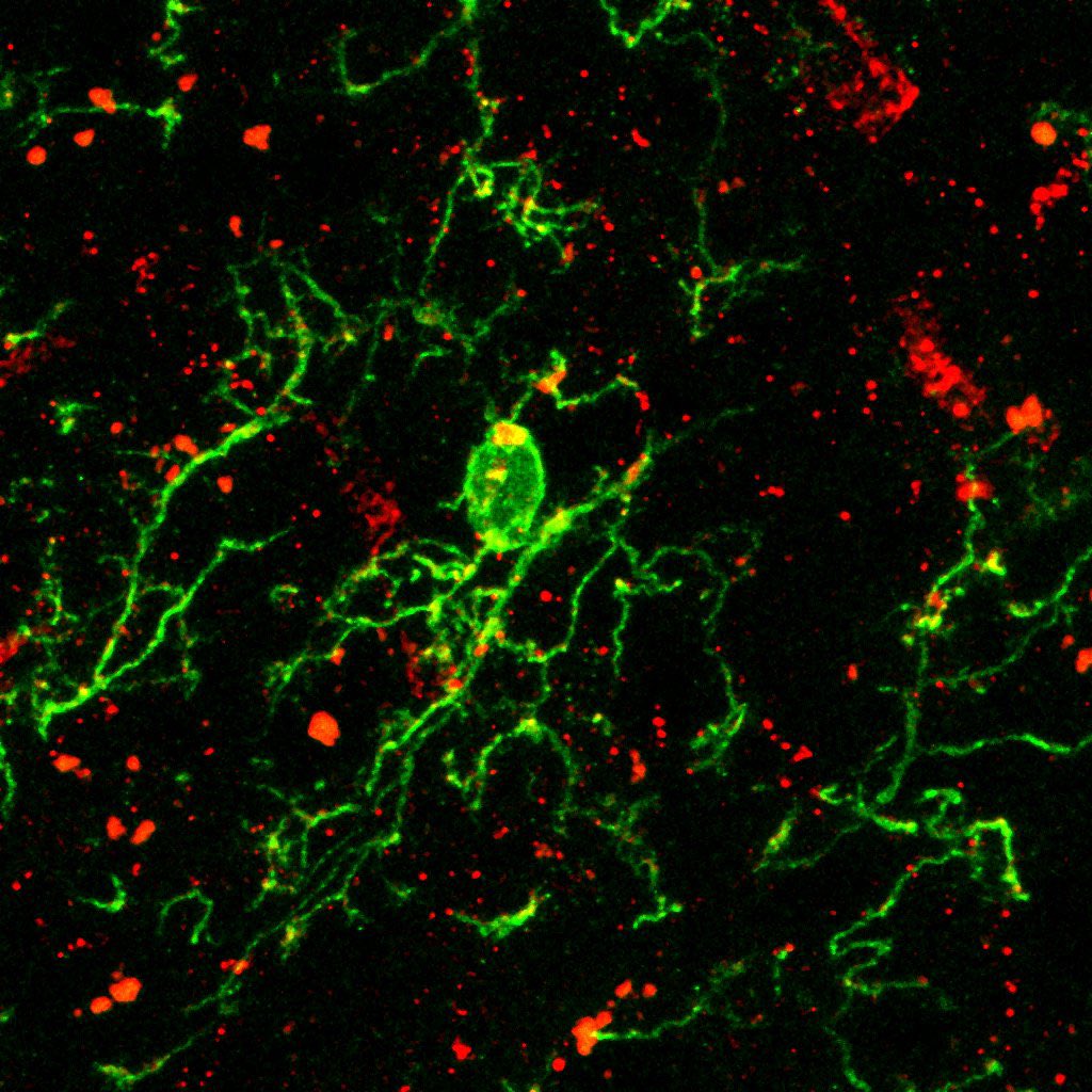 Haven’t posted anything on X but I am continuing growing my own areas. We wrote a small piece on T2D/AD/NPS, with a student I mentored in Bordeaux School of Neuroscience as a mini-project I brought in. Also with my long-time science buddy <a href="/HongbinYang568/">HB Yang</a> 
journals.lww.com/nrronline/cita…