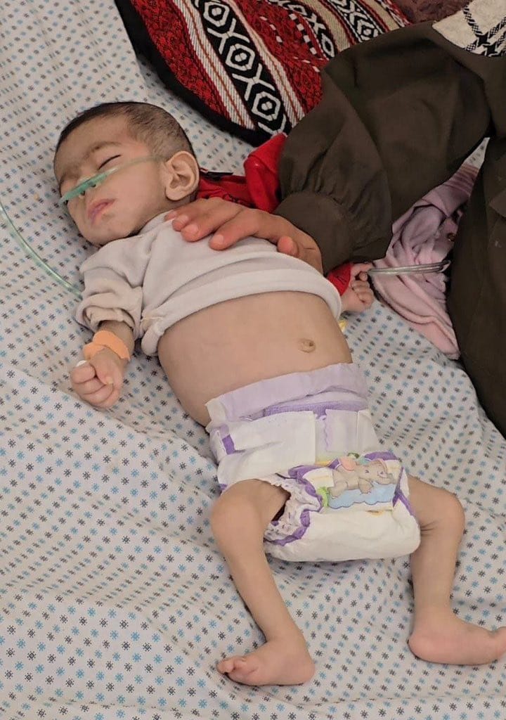 عمر بن عبدالعزیز فرمایا کرتے تھے:
"پہاڑوں کی چوٹیوں پر گندم بکھیر دو
تاکہ یہ نہ کہا جائے کہ مسلمانوں کے ملک میں کوئی پرندہ بھوکا رہا"

یہ جَنان ہے، جو بھوک سے مر گئی😭

اللہ تم پر رحم فرمائے اے عمر!
آج تو مسلمانوں کے ملک میں بچے بھی بھوک سے مر رہے ہیں!💔