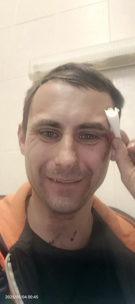 4erva4ok91's tweet photo. Вот это покатушки на самокате😂ничего не помню, но было очень интересно😅особенно мужику забирать из больницы меня в 3 часа ночи 🤪 https://t.co/esal13TtEr