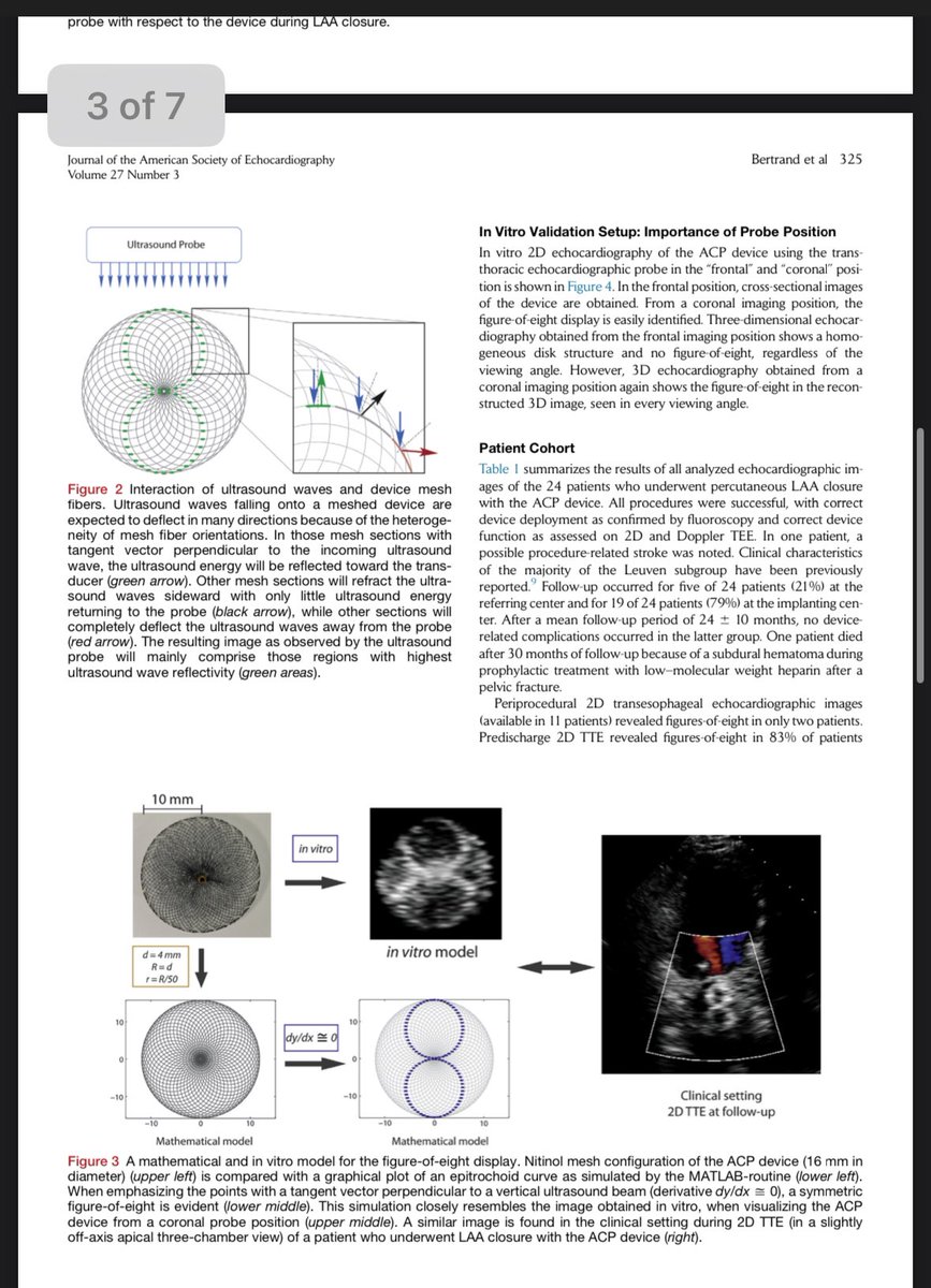 <a href="/DrRajeshG1/">Dr G Rajesh (Gopalan Nair Rajesh).</a> <a href="/ecgrhythms/">Arnel Carmona</a> Was absolutely fascinated behind the physics when I first read it!

asecho.org/wp-content/upl…