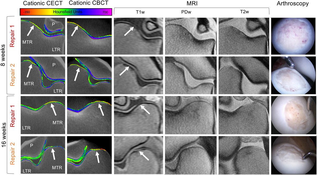 Nazir Khan (@nazirkhan1) on Twitter photo Happy #DerbyDay! 🐎
This <a href="/JOrthopRes/">Journal of Orthopaedic Research®</a> study uses in vivo cationic CECT to track cartilage repair in an equine model-bridging diagnostics across species.
Great science supporting peak joint performance in horses and humans!
doi.org/10.1002/jor.25…
#ORSSMC #ORSxDerby #KyDerby Happy #DerbyDay! 🐎
This <a href="/JOrthopRes/">Journal of Orthopaedic Research®</a> study uses in vivo cationic CECT to track cartilage repair in an equine model-bridging diagnostics across species.
Great science supporting peak joint performance in horses and humans!
doi.org/10.1002/jor.25…
#ORSSMC #ORSxDerby #KyDerby