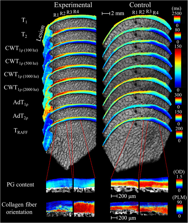Nazir Khan (@nazirkhan1) on Twitter photo This <a href="/JOrthopRes/">Journal of Orthopaedic Research®</a> study shows how quantitative MRI detects early cartilage degeneration in an equine model of PTOA-before damage is visible.
A leap forward in joint imaging across species!
🔗 doi.org/10.1002/jor.24…
<a href="/ORSsociety/">Orthopaedic Research Society</a> #ORSSMC #ORSxDerby #KyDerby #EquineResearch #qMRI This <a href="/JOrthopRes/">Journal of Orthopaedic Research®</a> study shows how quantitative MRI detects early cartilage degeneration in an equine model of PTOA-before damage is visible.
A leap forward in joint imaging across species!
🔗 doi.org/10.1002/jor.24…
<a href="/ORSsociety/">Orthopaedic Research Society</a> #ORSSMC #ORSxDerby #KyDerby #EquineResearch #qMRI