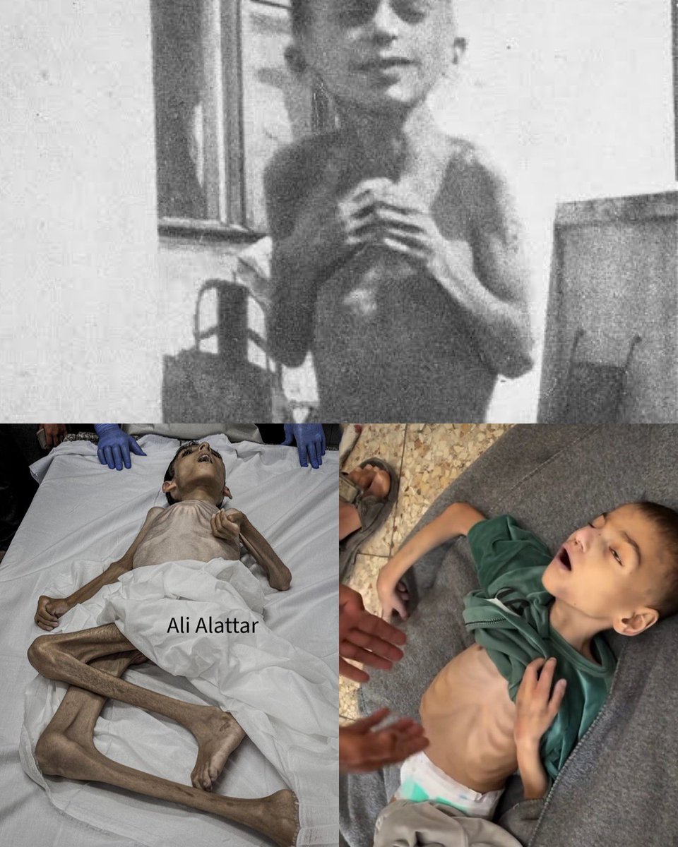 RamAbdu's tweet photo. Above: A starving child sits on a stool in a hospital in the Warsaw Ghetto.

Below: Children who lost their lives at Al-Ahli Baptist Hospital in Gaza City, victims of Israel’s starvation policy. https://t.co/Hm6PIEQ7Ut