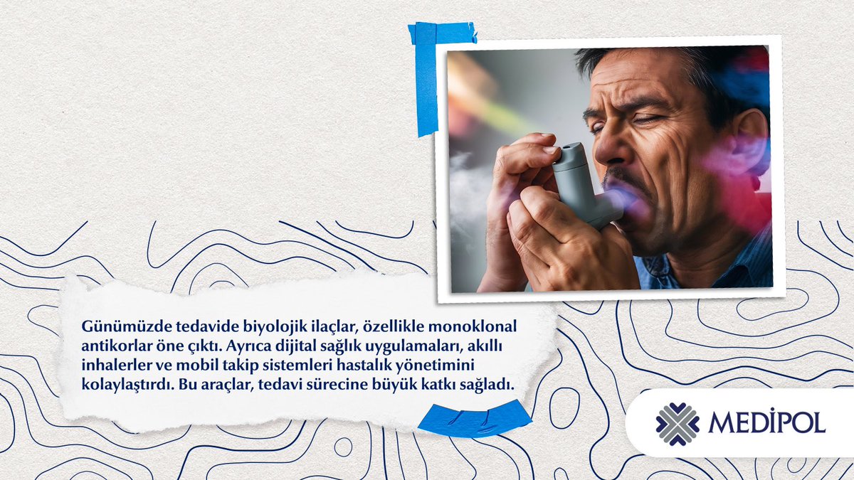 Astımın tarihsel sürecini biliyor muydunuz? 

😮‍💨Astım, 19. yüzyılda alerjik bir hastalık olarak tanımlanmış, zamanla çevresel ve genetik faktörlerle şekillenen kronik bir solunum hastalığı olduğu anlaşılmıştır.

✨Bugün, biyolojik ilaçlar ve dijital sağlık uygulamaları sayesinde