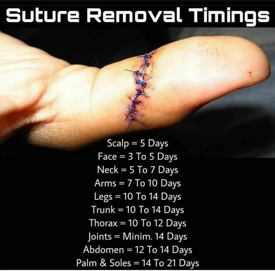 MoAImam's tweet image. Might be variable.