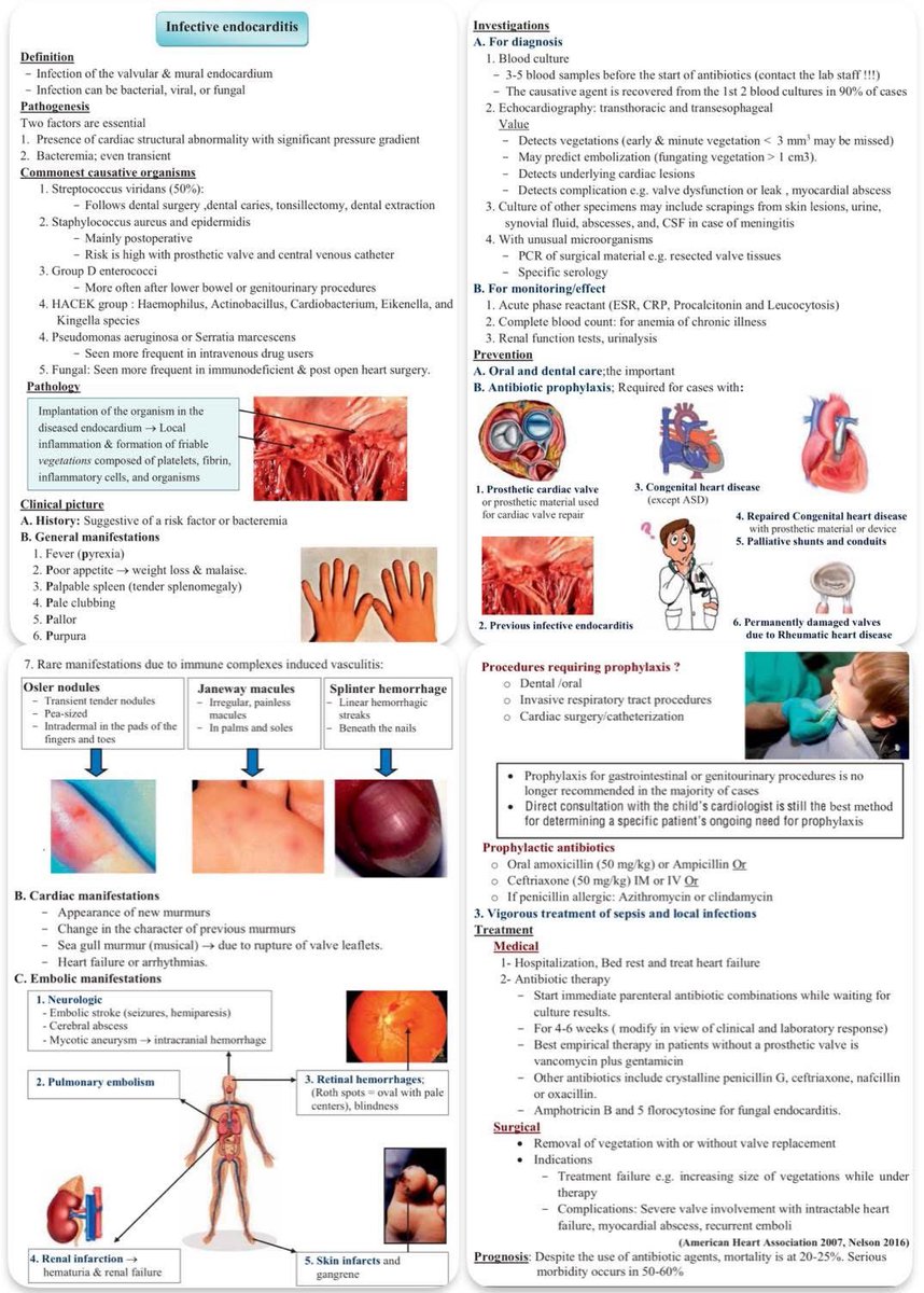 Infective endocarditis