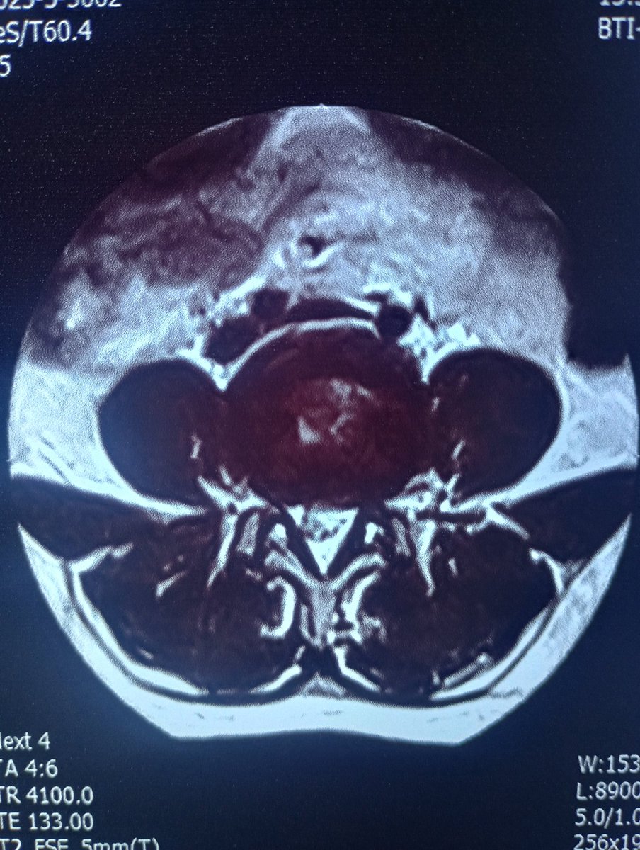 No back pain is innocent