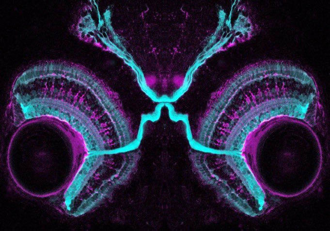 Zebrafish Rock! (@zebrafishrock) on Twitter photo Want more Star Wars content? Enjoy this zebrafish optic chiasm turned podracer, which is sure to leave your competitors in the depths. Credit to Dr. Kara Cerveny & <a href="/stevewilsonfish/">Stephen Wilson</a>. #MayThe4thBeWithYou #ZebrafishZunday Want more Star Wars content? Enjoy this zebrafish optic chiasm turned podracer, which is sure to leave your competitors in the depths. Credit to Dr. Kara Cerveny & <a href="/stevewilsonfish/">Stephen Wilson</a>. #MayThe4thBeWithYou #ZebrafishZunday