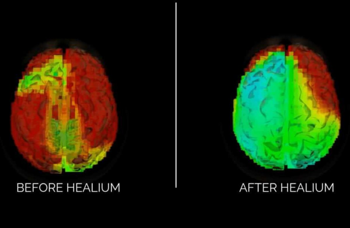 Today's critical product: <a href="/HealiumXR/">Healium</a>

Mindfulness and meditation with biofeedback is going to boom in popularity.

Healium is a virtual reality, biofeedback experience that is relaxing, surreal, and backed by science.

More importantly, it simply works.

I use it nearly everyday