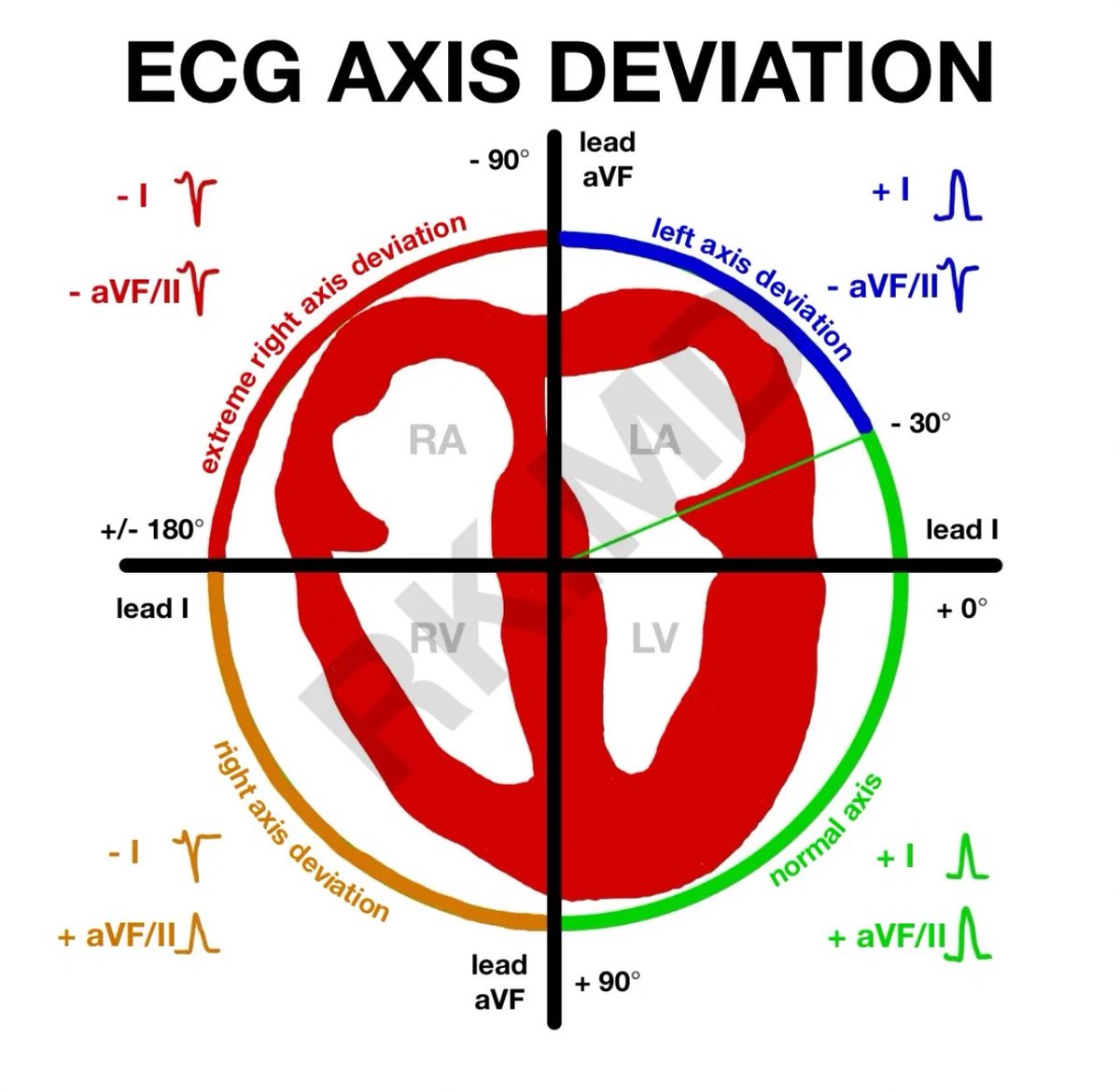 What is EKG axis deviation mean?