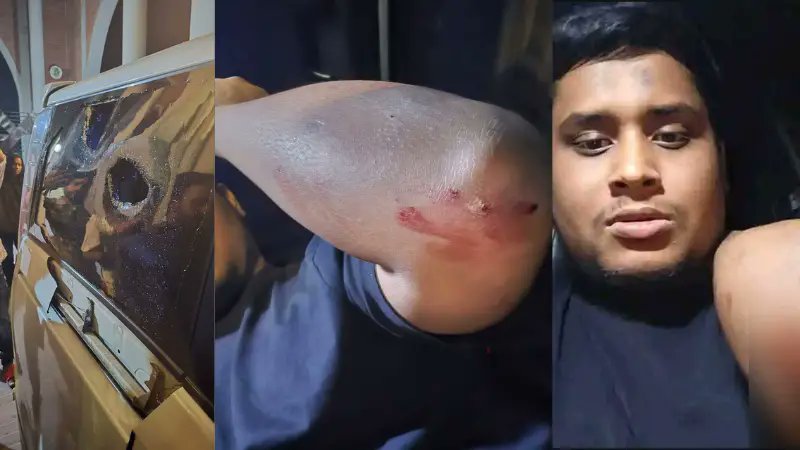 গাজীপুরে সন্ত্রাসী হামলায় আহত হাসনাত আব্দুল্লাহ!