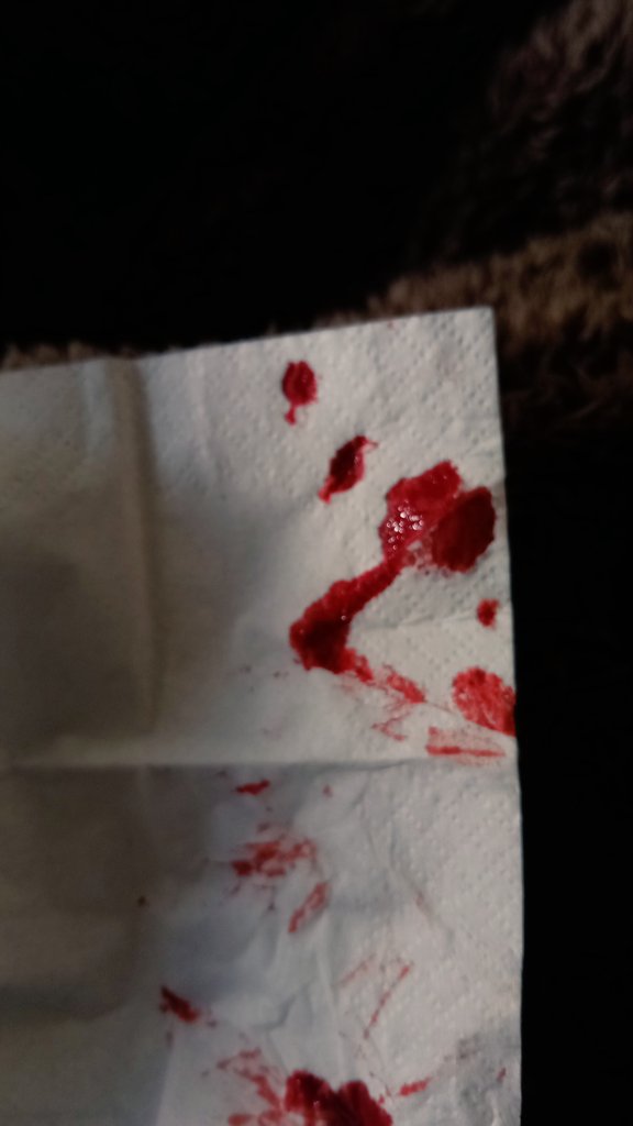 do yoi guys see that cock and balls 2