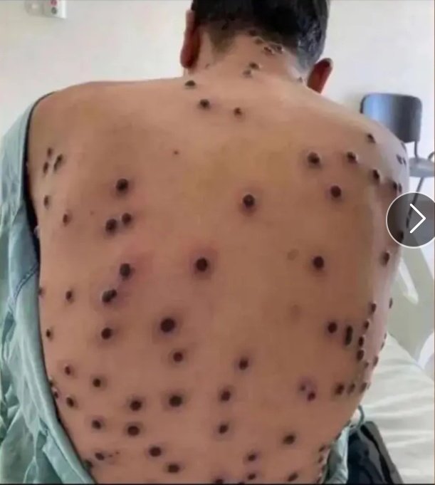 How do you fill when you see this ?
OMG 😱