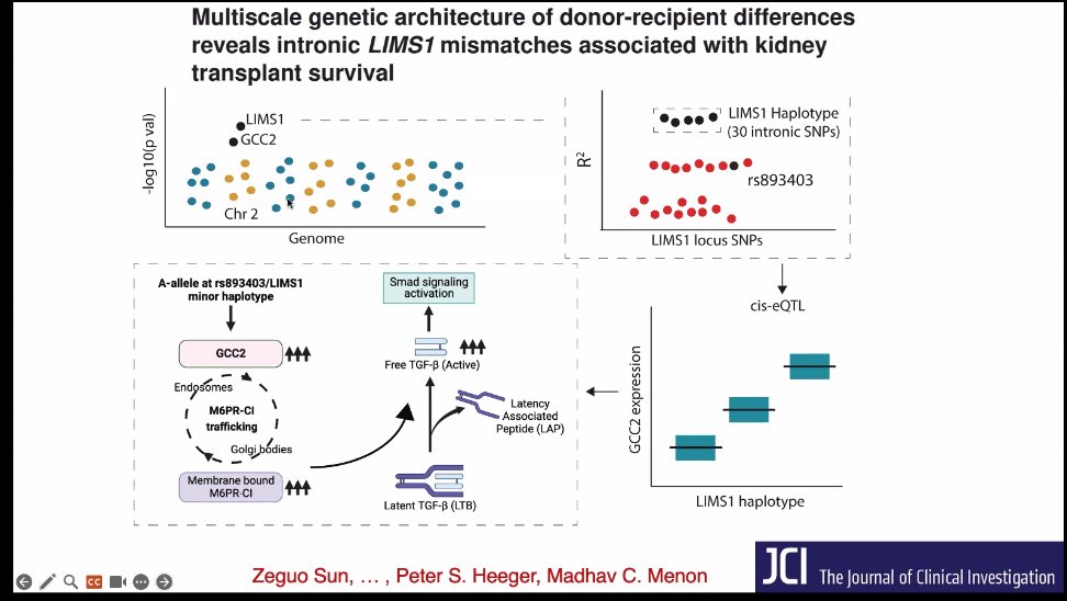 Izabela Zakrocka (@izabelazakrocka) on Twitter photo LIMS1 as a new target for kidney allograft survival by Dr Madhav Menon ✨thank you <a href="/GlomCon/">GlomCon</a> <a href="/yasar_caliskan/">Yasar Caliskan</a> <a href="/cravedilab/">Cravedi Lab</a> <a href="/CUIMCDeptofMed/">Columbia Department of Medicine</a> LIMS1 as a new target for kidney allograft survival by Dr Madhav Menon ✨thank you <a href="/GlomCon/">GlomCon</a> <a href="/yasar_caliskan/">Yasar Caliskan</a> <a href="/cravedilab/">Cravedi Lab</a> <a href="/CUIMCDeptofMed/">Columbia Department of Medicine</a>