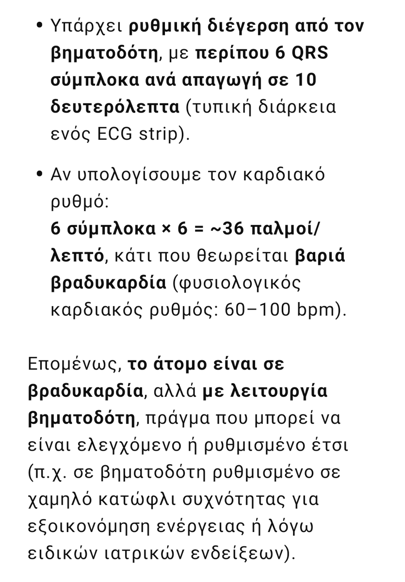 Η συνέχεια ανάγνωσης του ΗΚΓ στις 15:10 της Τζωρτζίνας από ΑΙ.
Τελικά ήταν εν ζωή σε βραδυκαρδία,όπως ακριβώς είπαν γιατροί εντός κι εκτός ΜΟΔ.
Ήταν κ.Τζ νεκρή στις 14:20; Αλήθεια; Και τι κάνατε 80' σε νεκρό;
 #πατρα_δίκη #πατρα