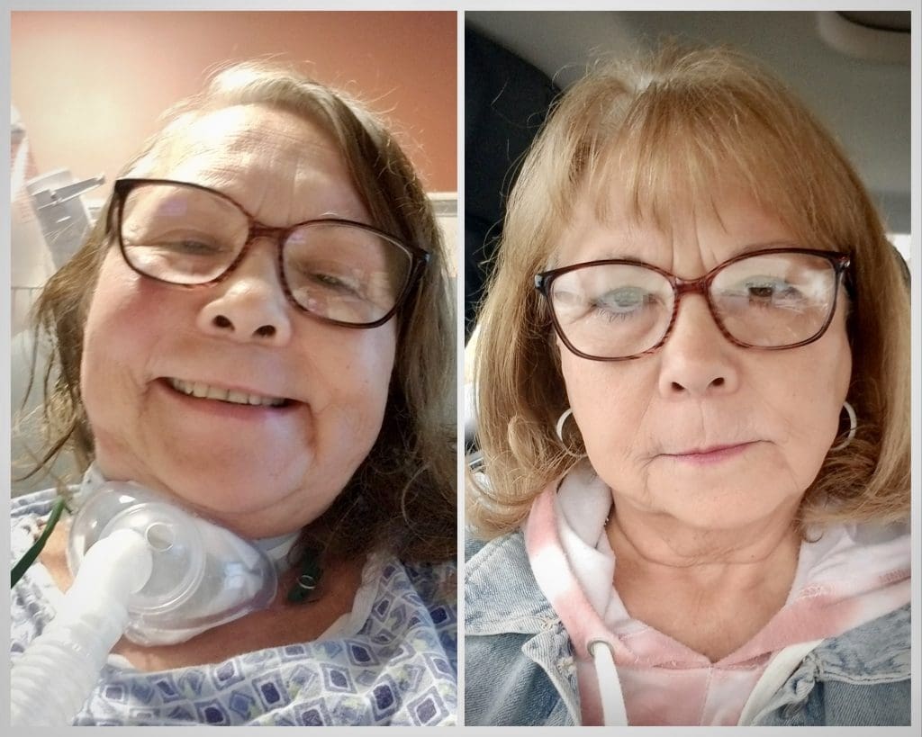 Stroke Awareness Month: We're sharing Cynthia Brooks’ story to highlight the importance of knowing the signs and acting fast. After suffering two strokes, Cynthia spent 87 days in the hospital and worked to regain her strength with the support of our team. bit.ly/42J8rGL